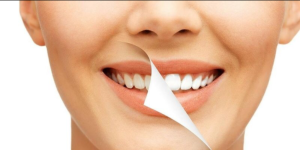 Sorriso perfeito: 10 dicas indispensáveis para ter um