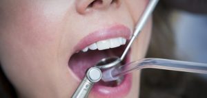 Cárie na fase adulta? Veja os sinais, os tratamentos e como prevenir