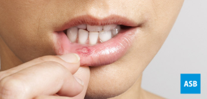 Herpes labial: como identificar, tratar e evitar a doença