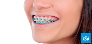 Auxiliar de dentista pode colocar aparelho nos pacientes?