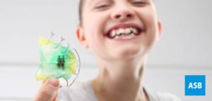 Afinal, por que os dentes encavalam? Descubra neste post