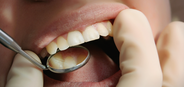 Bruxismo: como saber se tenho e qual o tratamento?