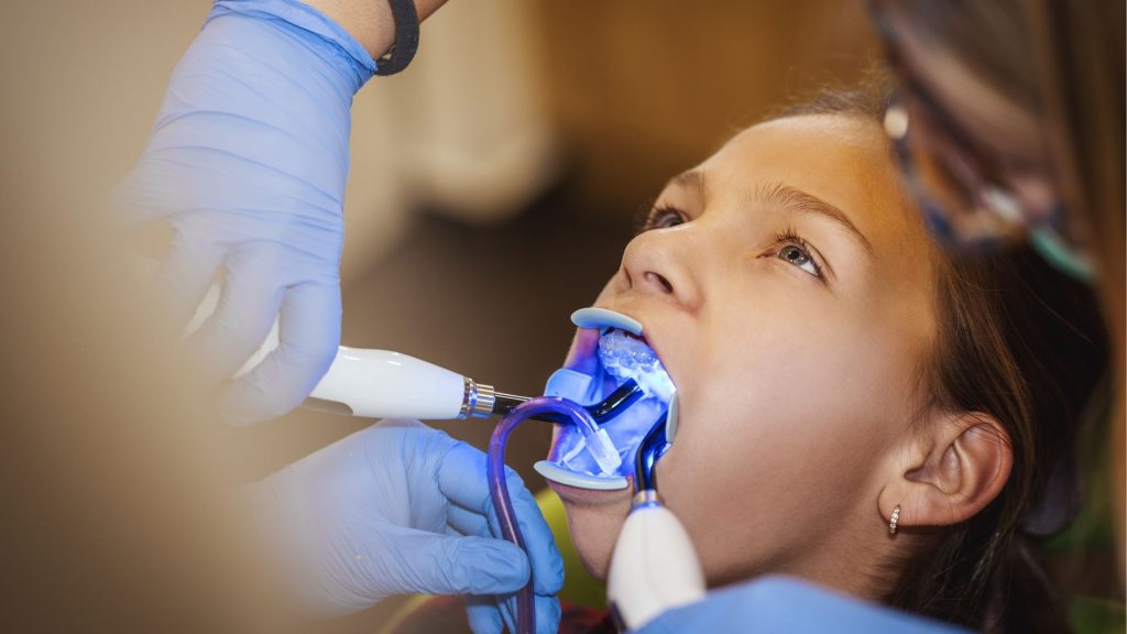 Posso fazer clareamento de aparelho?