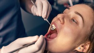 Minha língua está branca. O que devo fazer?